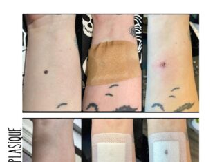 L’horreur au service de la prévention : le projet de l’artiste Charlotte Pimentel face au cancer de la peau